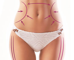 lidia-rasero-nutricion-bienestar-belleza-tratamientos-belleza-mesoterapia