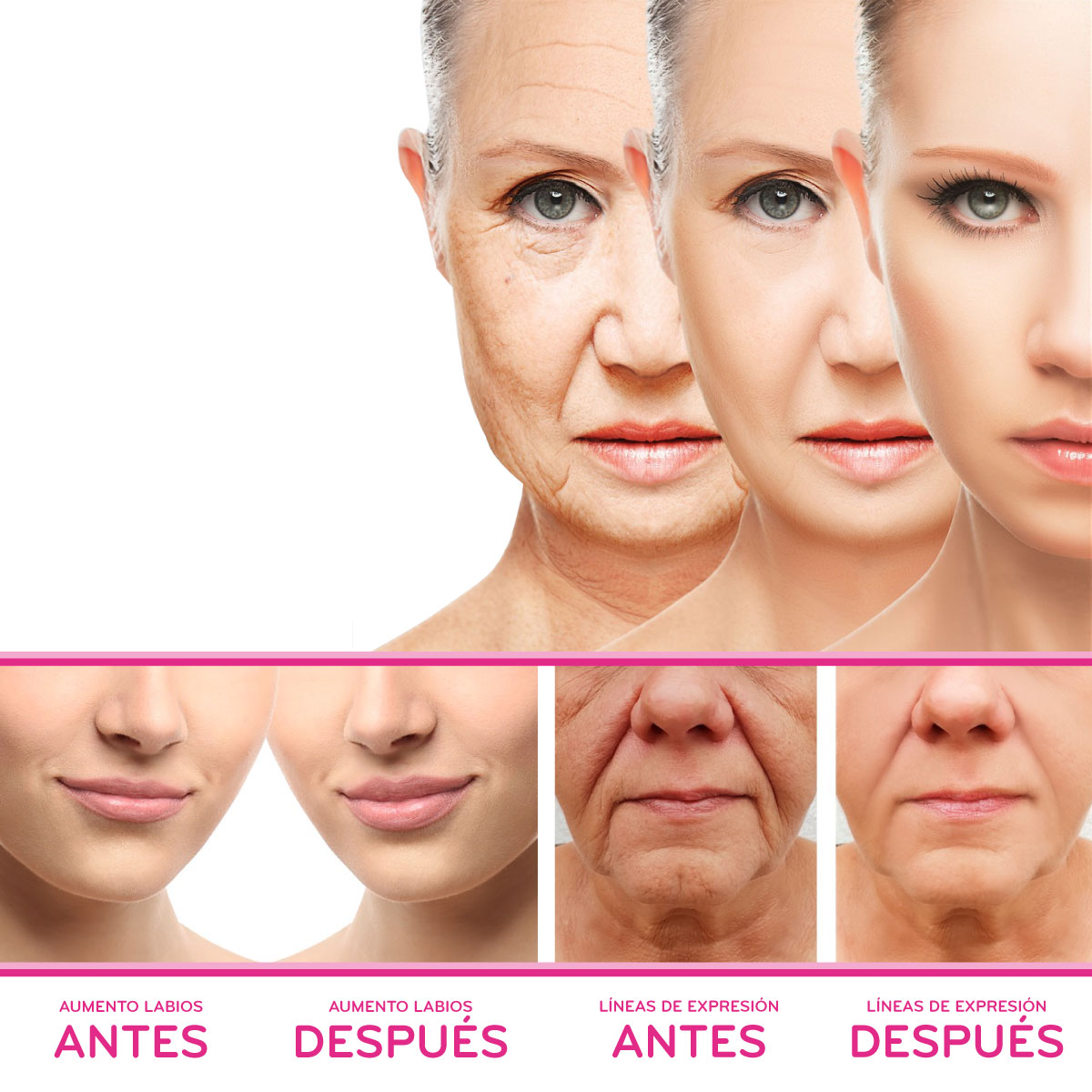 lidiarasero-nutricion-bienestar-belleza-centro-tratamientos-medico-dermoesteticos-antes-y-despues